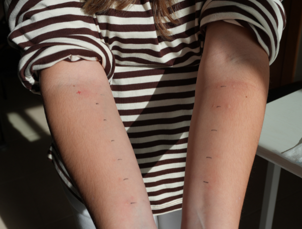 Al·lèrgia a la primavera: per què apareix i com ens podem avançar