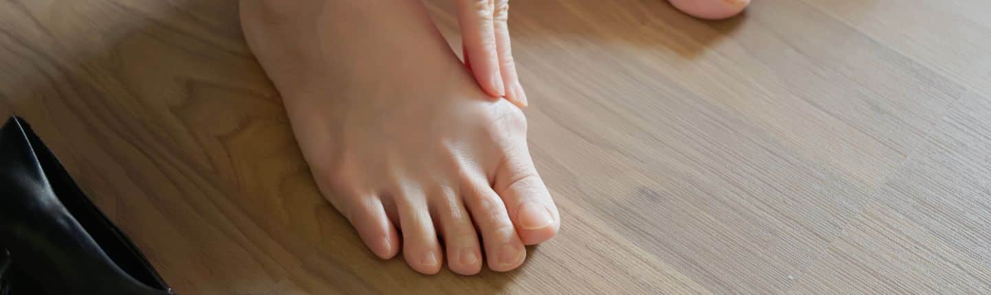 Hallux Valgus 1