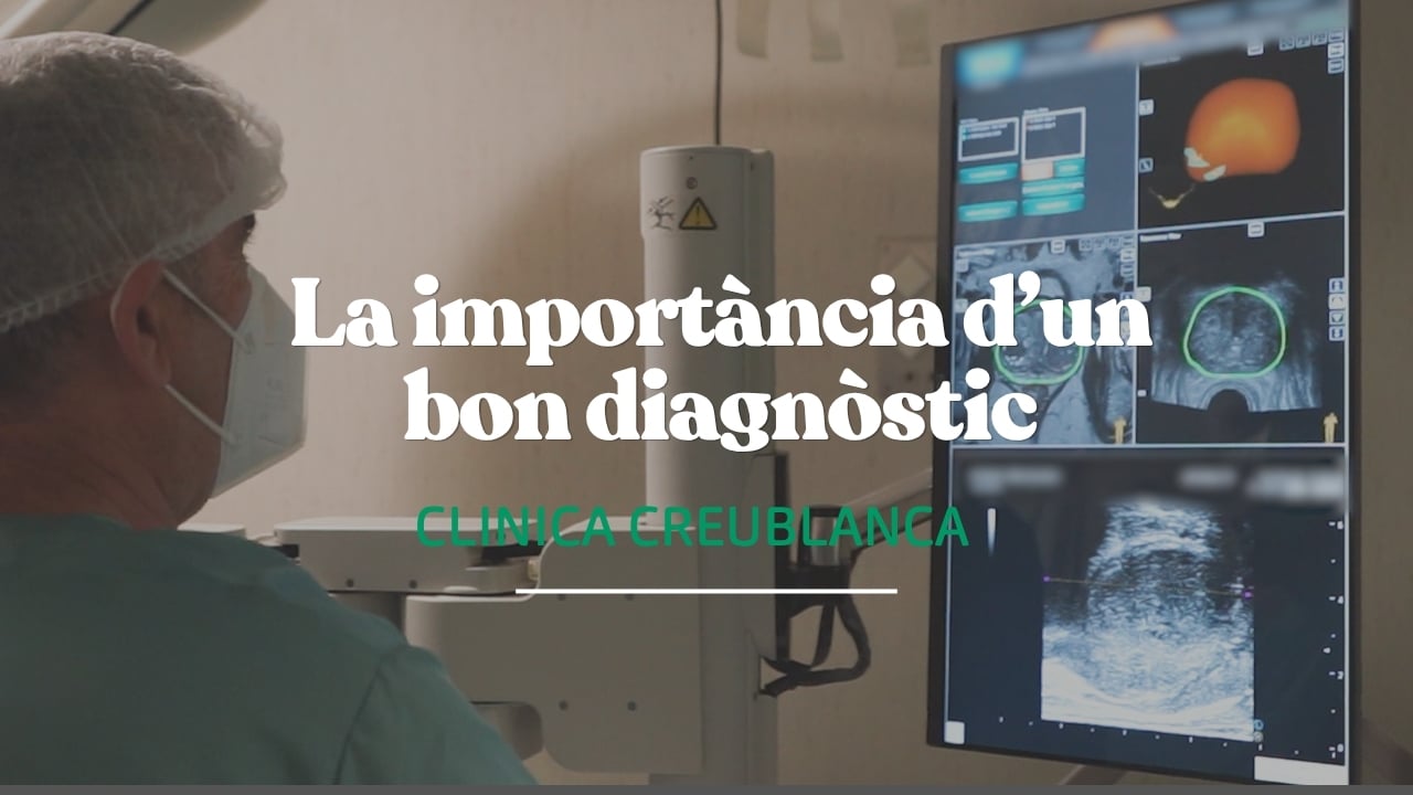PSA elevat: la imatge que ho canvia tot